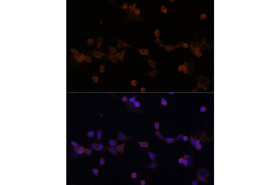 Immunofluorescence - Anti-Ube2L3/UBCH7 Antibody (A14531) - Antibodies.com