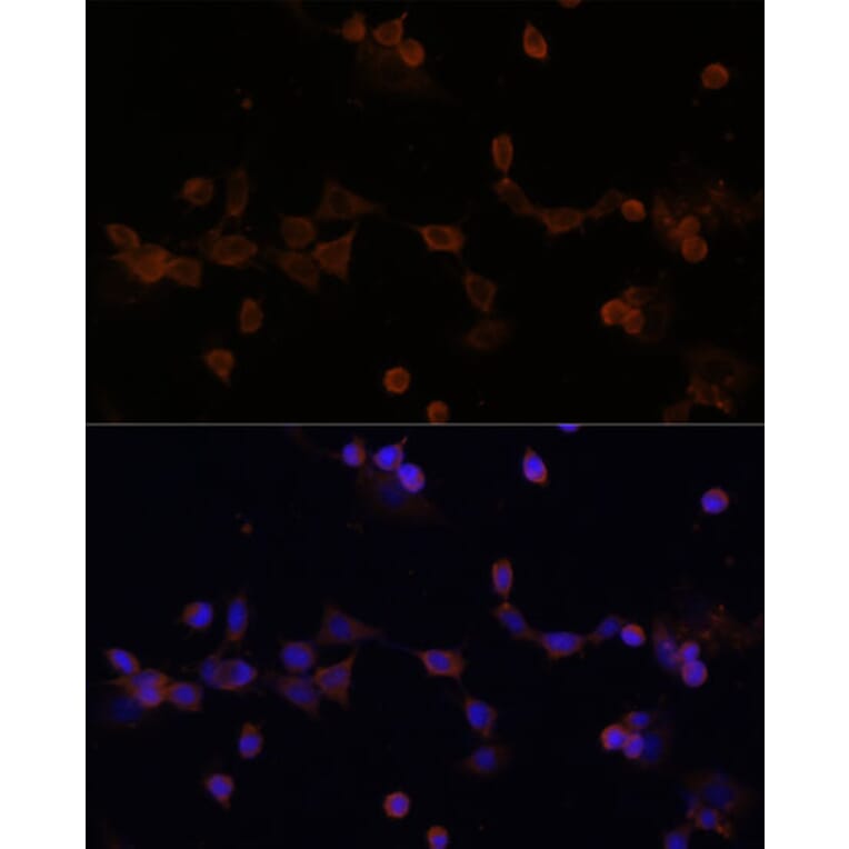 Immunofluorescence - Anti-Ube2L3/UBCH7 Antibody (A14531) - Antibodies.com