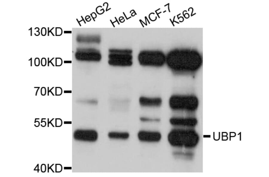 Western Blot - Anti-UBP1 Antibody (A4177) - Antibodies.com