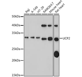 Western Blot - Anti-UCP2 Antibody (A14533) - Antibodies.com