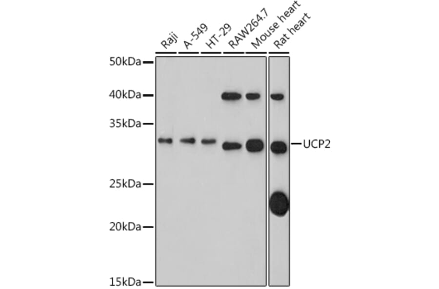 Western Blot - Anti-UCP2 Antibody (A14533) - Antibodies.com