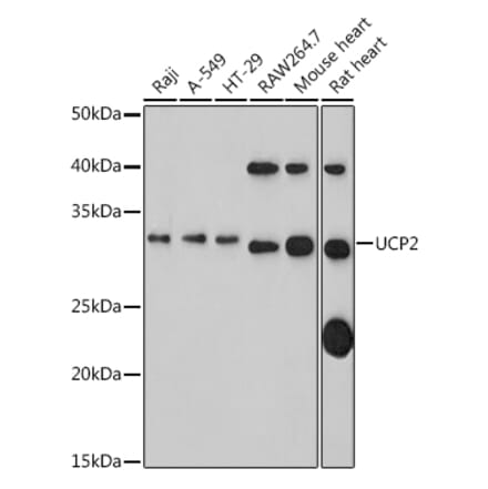 Western Blot - Anti-UCP2 Antibody (A14533) - Antibodies.com