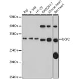 Western Blot - Anti-UCP2 Antibody (A14533) - Antibodies.com