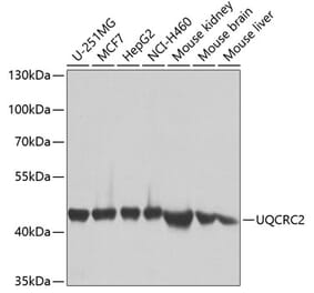 Western Blot - Anti-UQCRC2 Antibody (A14534) - Antibodies.com
