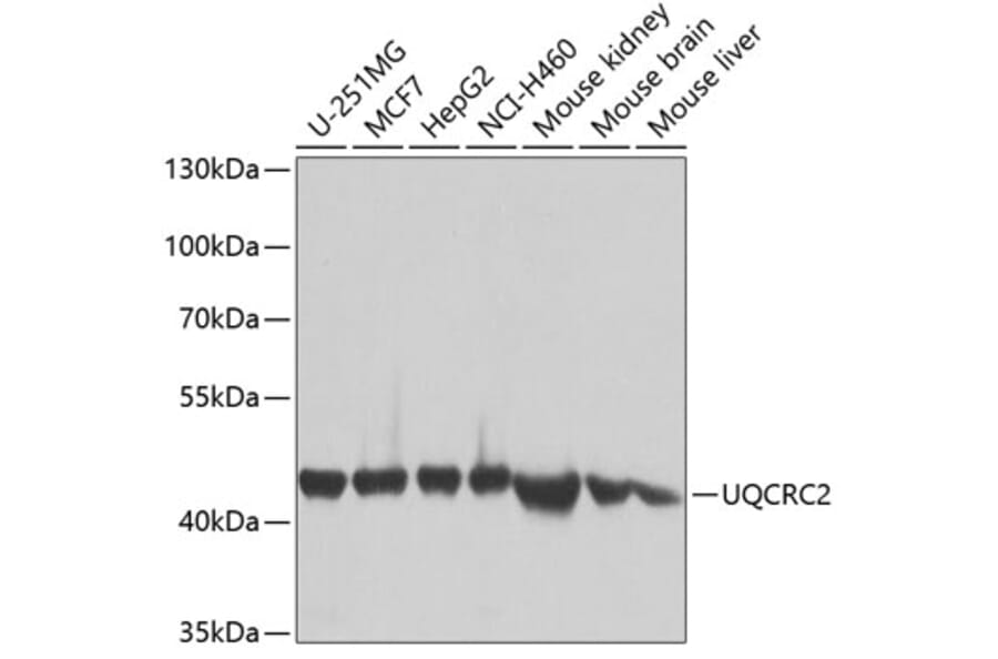 Western Blot - Anti-UQCRC2 Antibody (A14534) - Antibodies.com