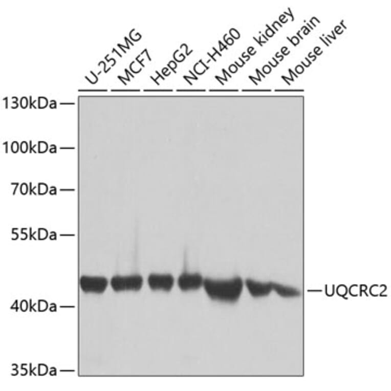 Western Blot - Anti-UQCRC2 Antibody (A14534) - Antibodies.com