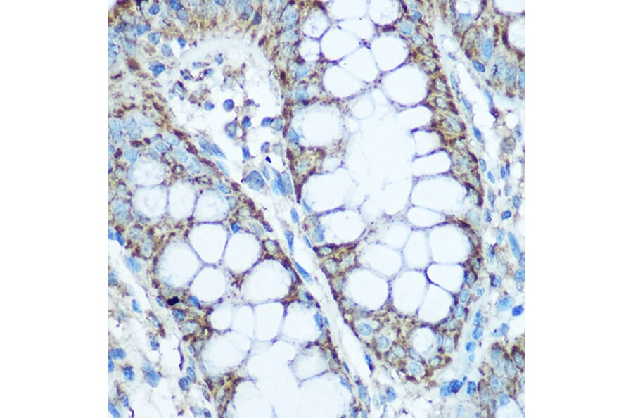Immunohistochemistry - Anti-UQCRC2 Antibody (A14534) - Antibodies.com