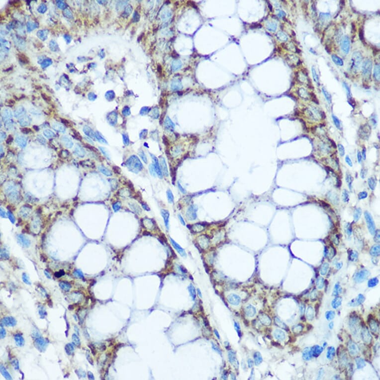 Immunohistochemistry - Anti-UQCRC2 Antibody (A14534) - Antibodies.com