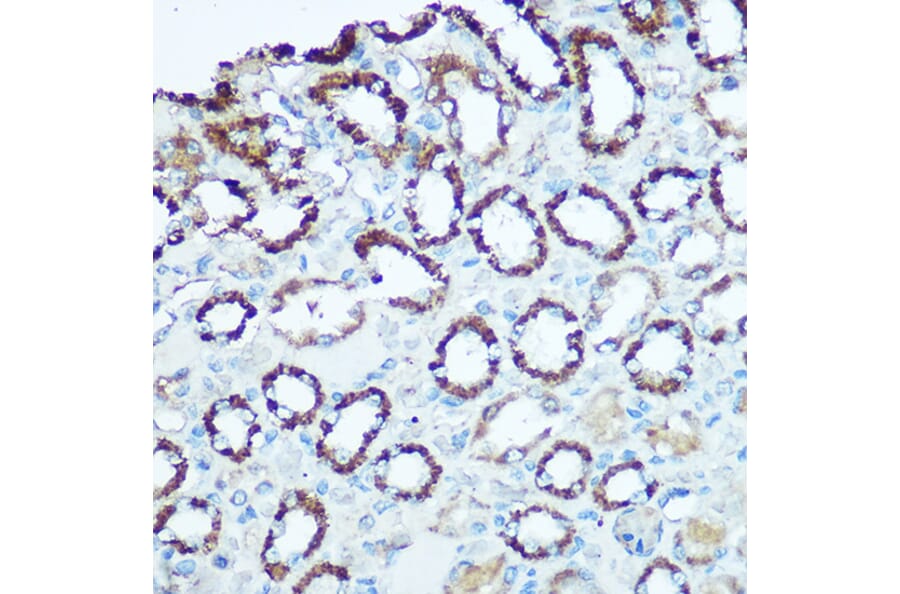 Immunohistochemistry - Anti-UQCRC2 Antibody (A14534) - Antibodies.com