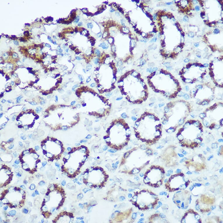 Immunohistochemistry - Anti-UQCRC2 Antibody (A14534) - Antibodies.com