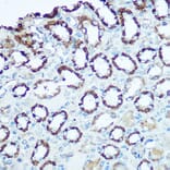 Immunohistochemistry - Anti-UQCRC2 Antibody (A14534) - Antibodies.com