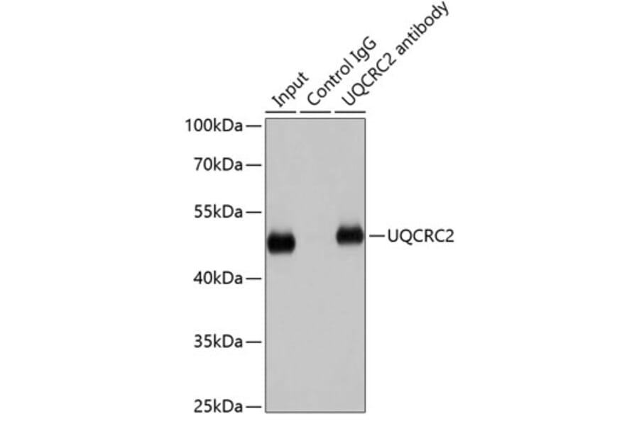 Western Blot - Anti-UQCRC2 Antibody (A14534) - Antibodies.com