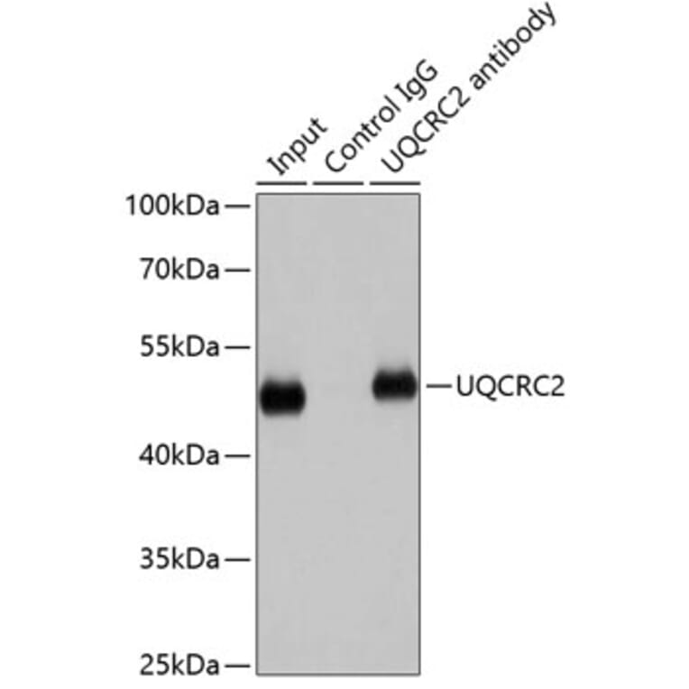 Western Blot - Anti-UQCRC2 Antibody (A14534) - Antibodies.com