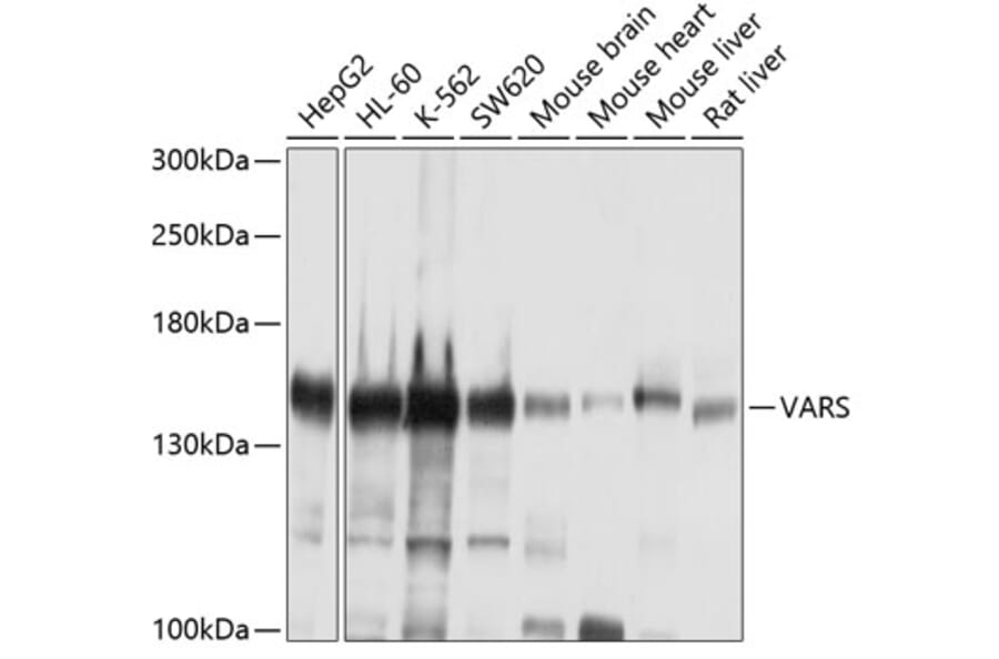 Western Blot - Anti-valyl tRNA synthetase Antibody (A14535) - Antibodies.com