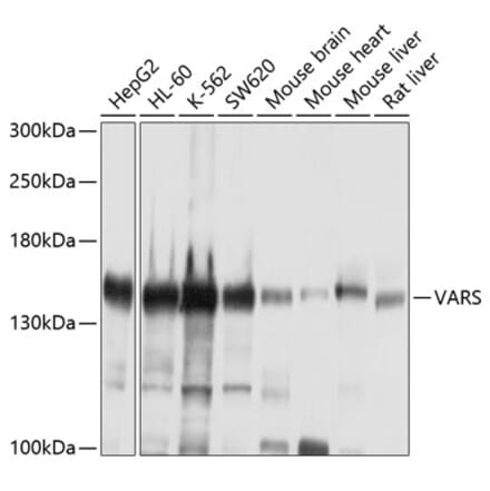 Western Blot - Anti-valyl tRNA synthetase Antibody (A14535) - Antibodies.com