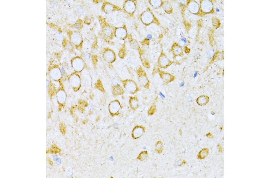 Immunohistochemistry - Anti-valyl tRNA synthetase Antibody (A14535) - Antibodies.com