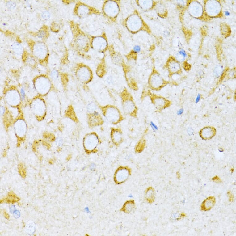 Immunohistochemistry - Anti-valyl tRNA synthetase Antibody (A14535) - Antibodies.com