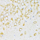 Immunohistochemistry - Anti-valyl tRNA synthetase Antibody (A14535) - Antibodies.com