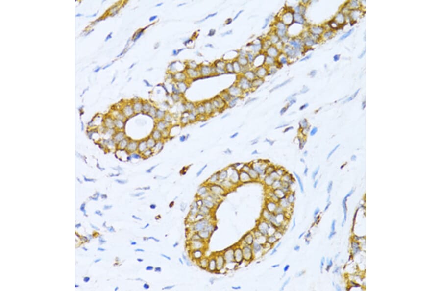 Immunohistochemistry - Anti-valyl tRNA synthetase Antibody (A14535) - Antibodies.com