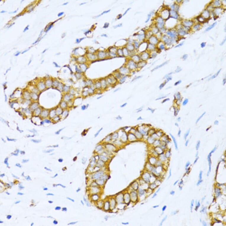Immunohistochemistry - Anti-valyl tRNA synthetase Antibody (A14535) - Antibodies.com