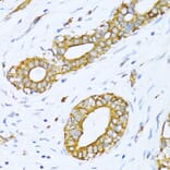 Immunohistochemistry - Anti-valyl tRNA synthetase Antibody (A14535) - Antibodies.com