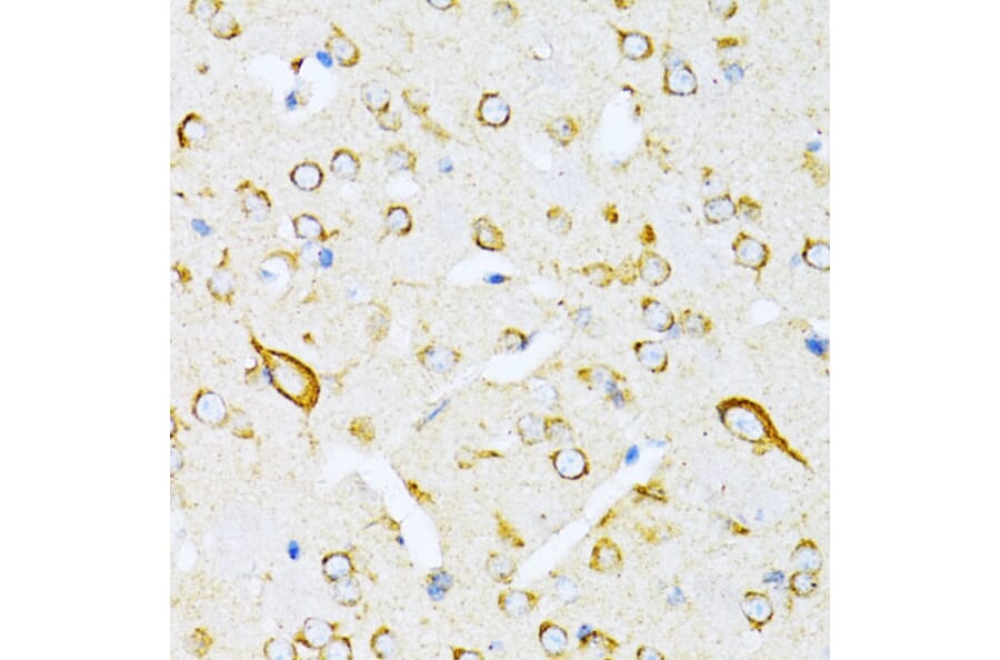 Immunohistochemistry - Anti-valyl tRNA synthetase Antibody (A14535) - Antibodies.com