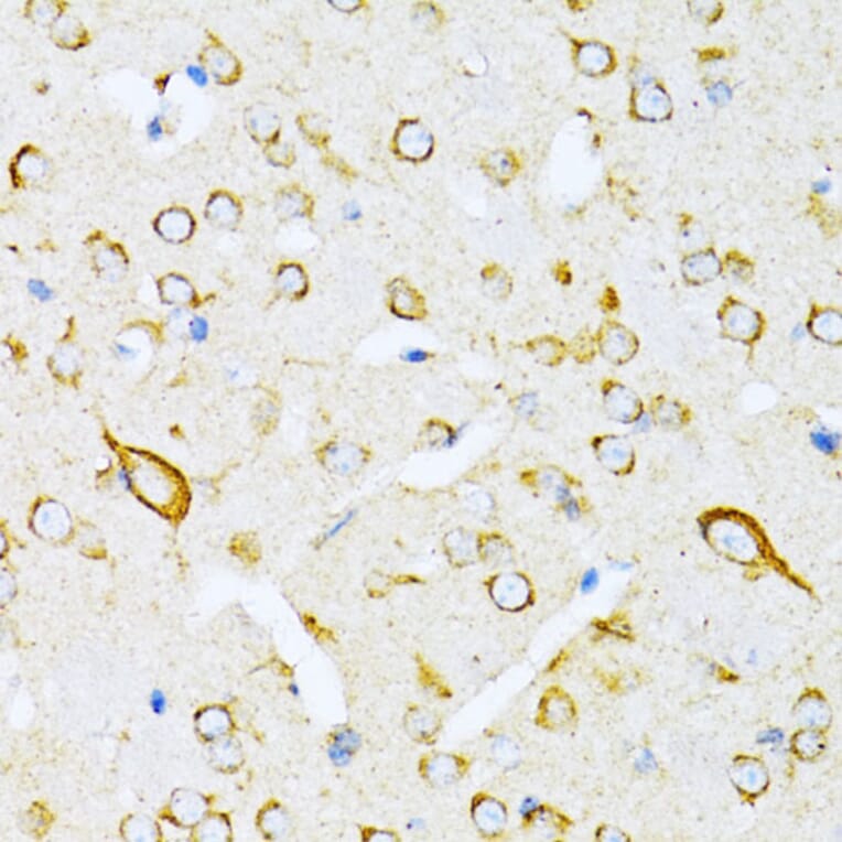 Immunohistochemistry - Anti-valyl tRNA synthetase Antibody (A14535) - Antibodies.com