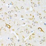 Immunohistochemistry - Anti-valyl tRNA synthetase Antibody (A14535) - Antibodies.com