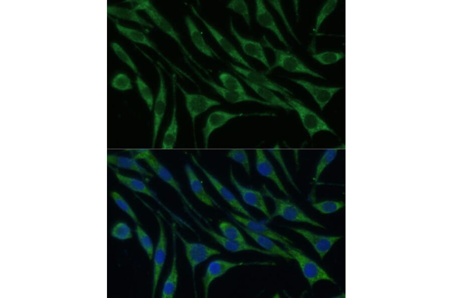 Immunofluorescence - Anti-valyl tRNA synthetase Antibody (A14535) - Antibodies.com