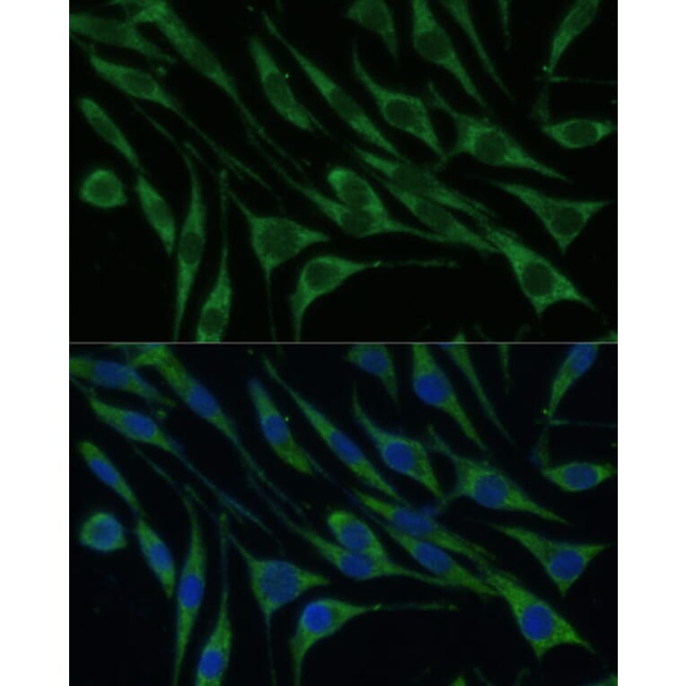 Immunofluorescence - Anti-valyl tRNA synthetase Antibody (A14535) - Antibodies.com