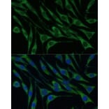 Immunofluorescence - Anti-valyl tRNA synthetase Antibody (A14535) - Antibodies.com