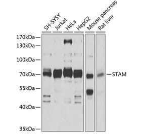 Western Blot - Anti-STAM1 Antibody (A14536) - Antibodies.com