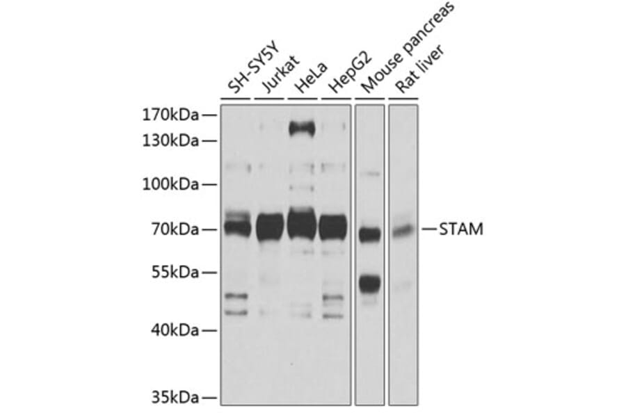 Western Blot - Anti-STAM1 Antibody (A14536) - Antibodies.com