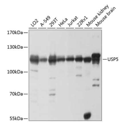 Western Blot - Anti-USP5 Antibody (A14537) - Antibodies.com