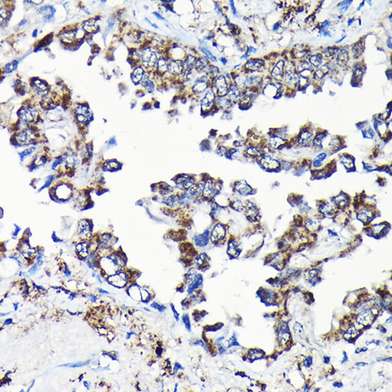 Immunohistochemistry - Anti-USP5 Antibody (A14537) - Antibodies.com