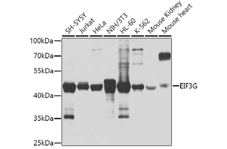 Western Blot - Anti-eIF3g Antibody (A14538) - Antibodies.com