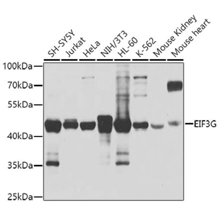 Western Blot - Anti-eIF3g Antibody (A14538) - Antibodies.com