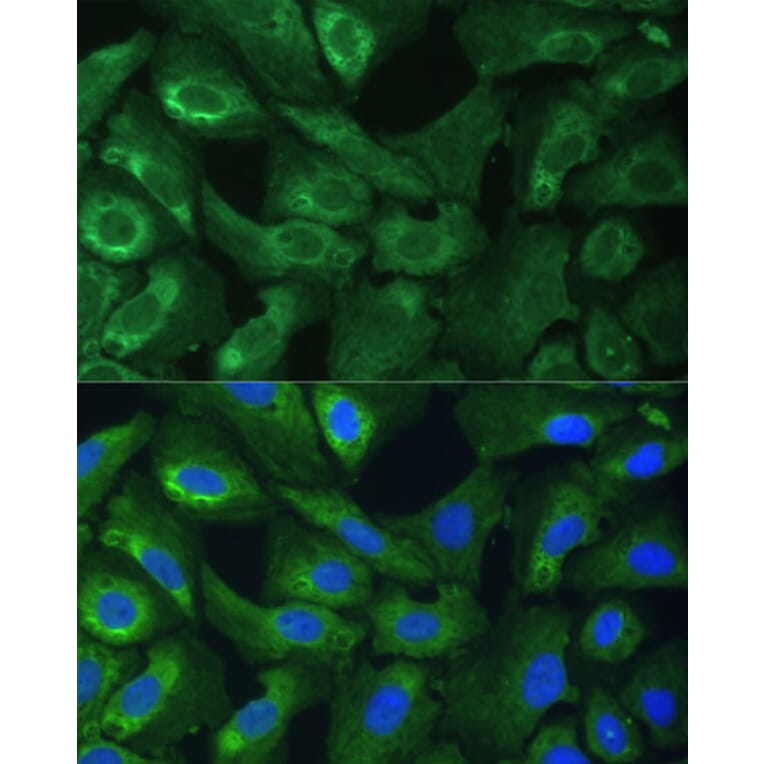 Immunofluorescence - Anti-eIF3g Antibody (A14538) - Antibodies.com