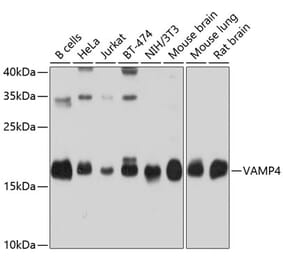 Western Blot - Anti-VAMP4 Antibody (A14539) - Antibodies.com