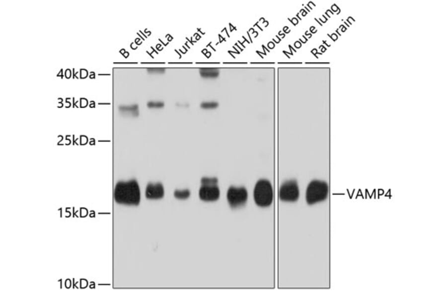 Western Blot - Anti-VAMP4 Antibody (A14539) - Antibodies.com