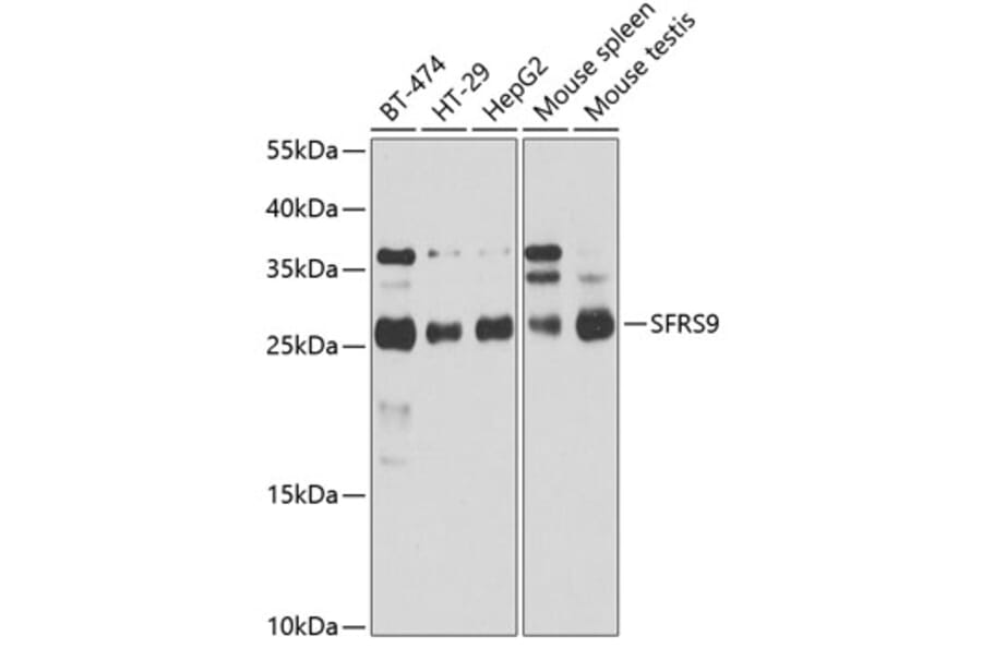 Western Blot - Anti-SFRS9 / SRSF9 Antibody (A14540) - Antibodies.com