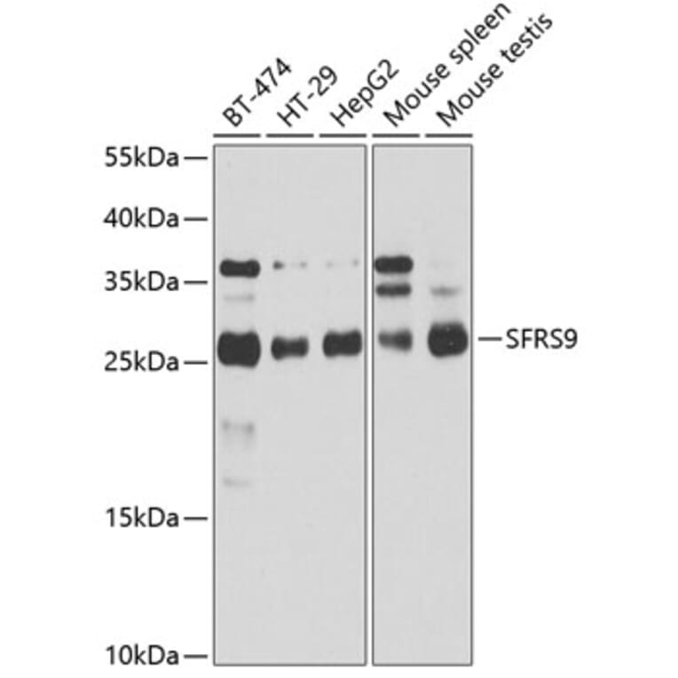 Western Blot - Anti-SFRS9 / SRSF9 Antibody (A14540) - Antibodies.com