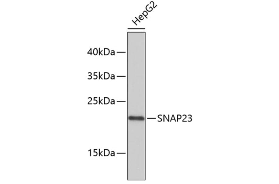Western Blot - Anti-SNAP23 Antibody (A4249) - Antibodies.com