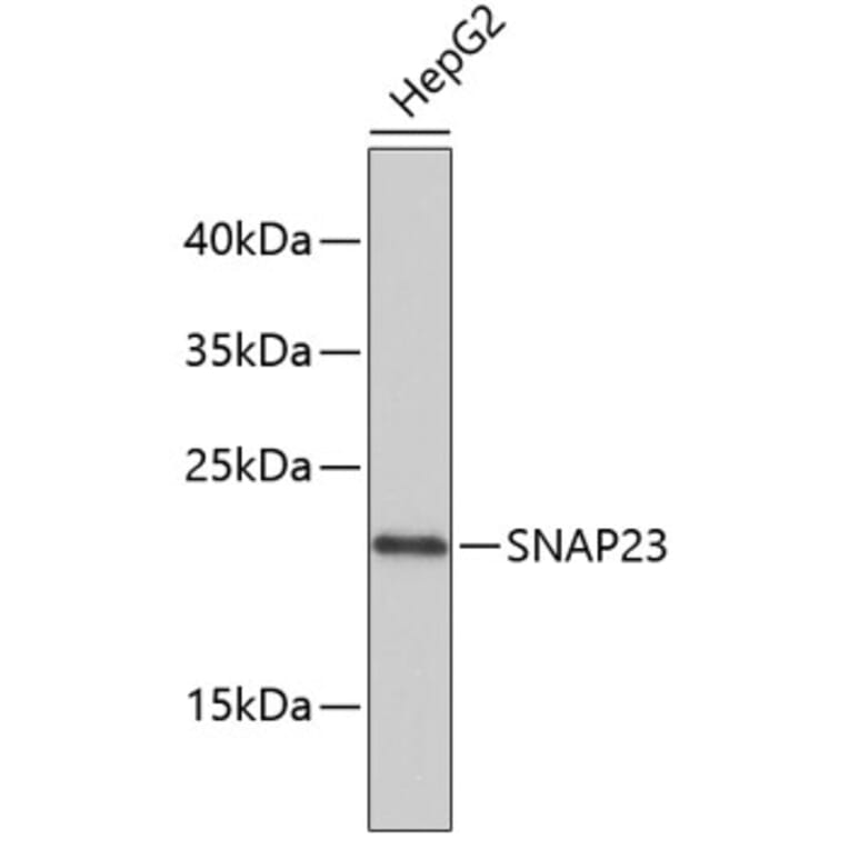 Western Blot - Anti-SNAP23 Antibody (A4249) - Antibodies.com