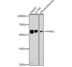 Western Blot - Anti-P4HA2 Antibody (A14543) - Antibodies.com