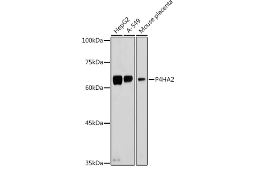Western Blot - Anti-P4HA2 Antibody (A14543) - Antibodies.com