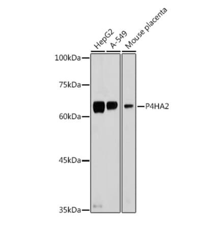 Western Blot - Anti-P4HA2 Antibody (A14543) - Antibodies.com