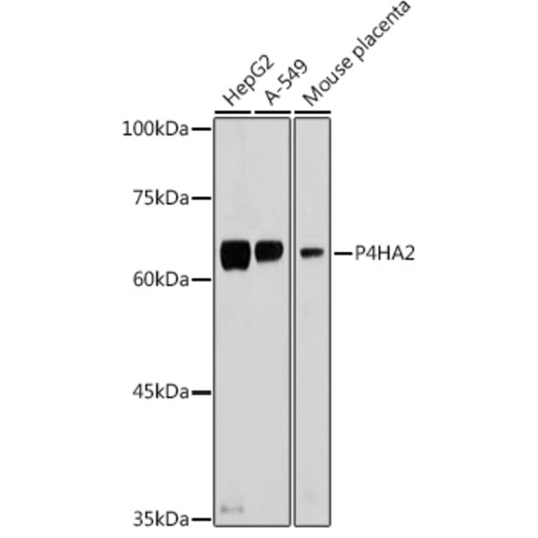 Western Blot - Anti-P4HA2 Antibody (A14543) - Antibodies.com