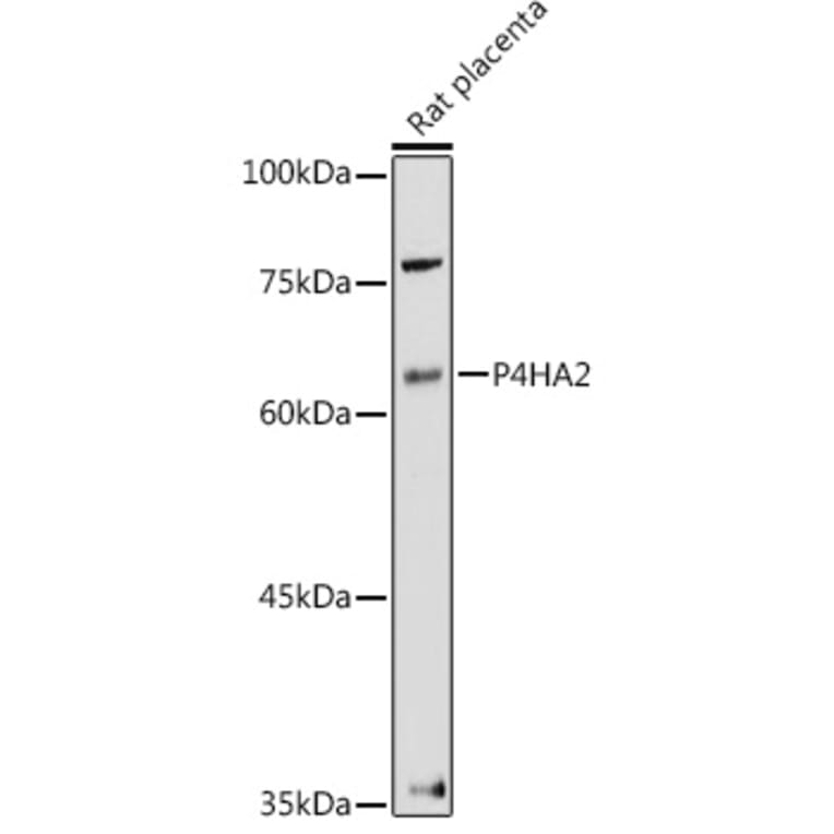 Western Blot - Anti-P4HA2 Antibody (A14543) - Antibodies.com