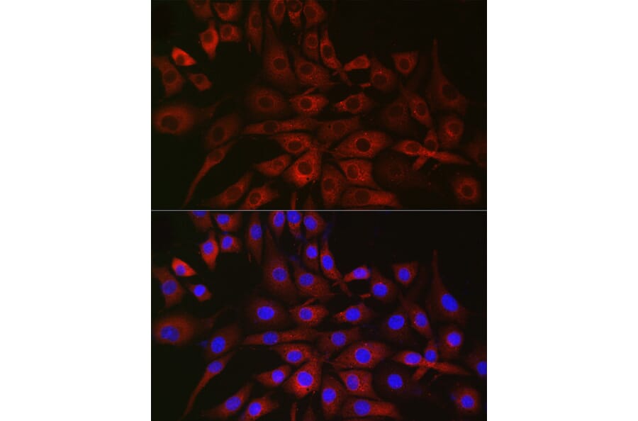 Immunofluorescence - Anti-P4HA2 Antibody (A14543) - Antibodies.com